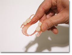 パルプラストデンチャー　やわらかいプラスチックの入れ歯
